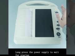 LCD/LED medische EKG-machine met meerdere leidingen USB / Bluetooth / WiFi gegevensoverdracht