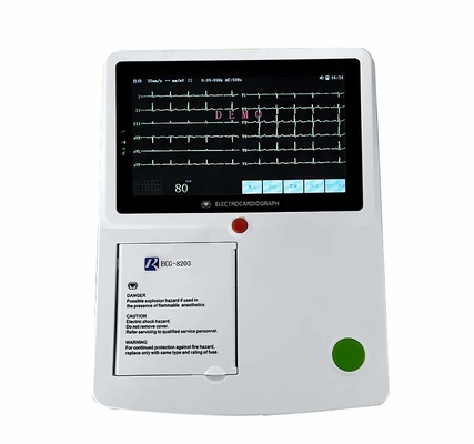 12 kanalen Digitale ECG Machine Hoge Resolusion met het Touche screen van Lidmaatelektroden