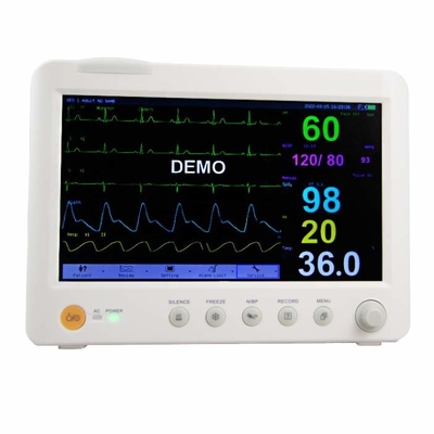 ECG/NIBP draagbare patiëntmonitor met meerdere parameters voor interne dataopslag in het ziekenhuis