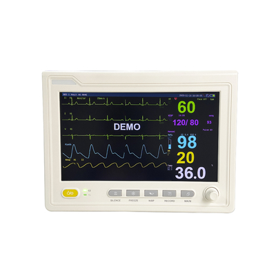 Medische apparatuur multi-parameter Patiëntmonitor met EKG spo2 ETCO2 NIBP resp tem monitor