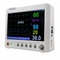 ECG/NIBP draagbare patiëntmonitor met meerdere parameters voor interne dataopslag in het ziekenhuis