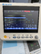 De Multiparametermonitor Mini Ambulance Patient Monitor van de het ziekenhuisnoodsituatie