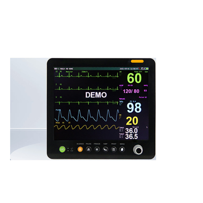 Medische EKG Monitor Vitale tekenen Patiënt Monitor Draagbaar Voor ziekenhuiskliniek