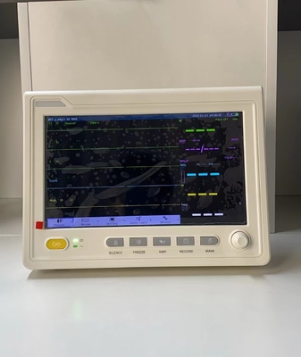 10.1 inch draagbare EKG-machine vitale symptomen patiëntmonitor voor ziekenhuisgebruik