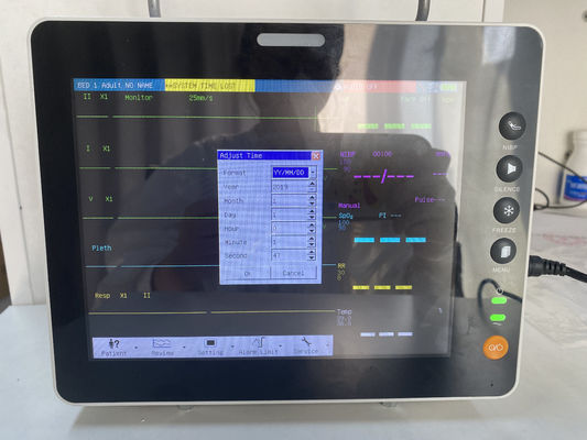 Draagbare multi-parameter patiëntmonitor met 1 jaar garantie, 2 jaar houdbaarheid en 7-kanaals ECG voor IC-gebruik