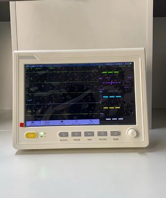 Draagbare 10,1 inch Multiparameter Patiëntmonitor voor Nauwkeurige Bewaking van Vitale Functies