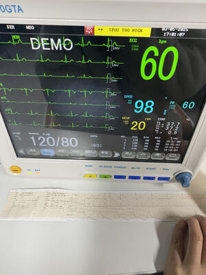 Draagbare bedmonitor met ECG SPO2 NIBP TEMP RESP Optioneel ETCO2-Klasse II 1 jaar garantie